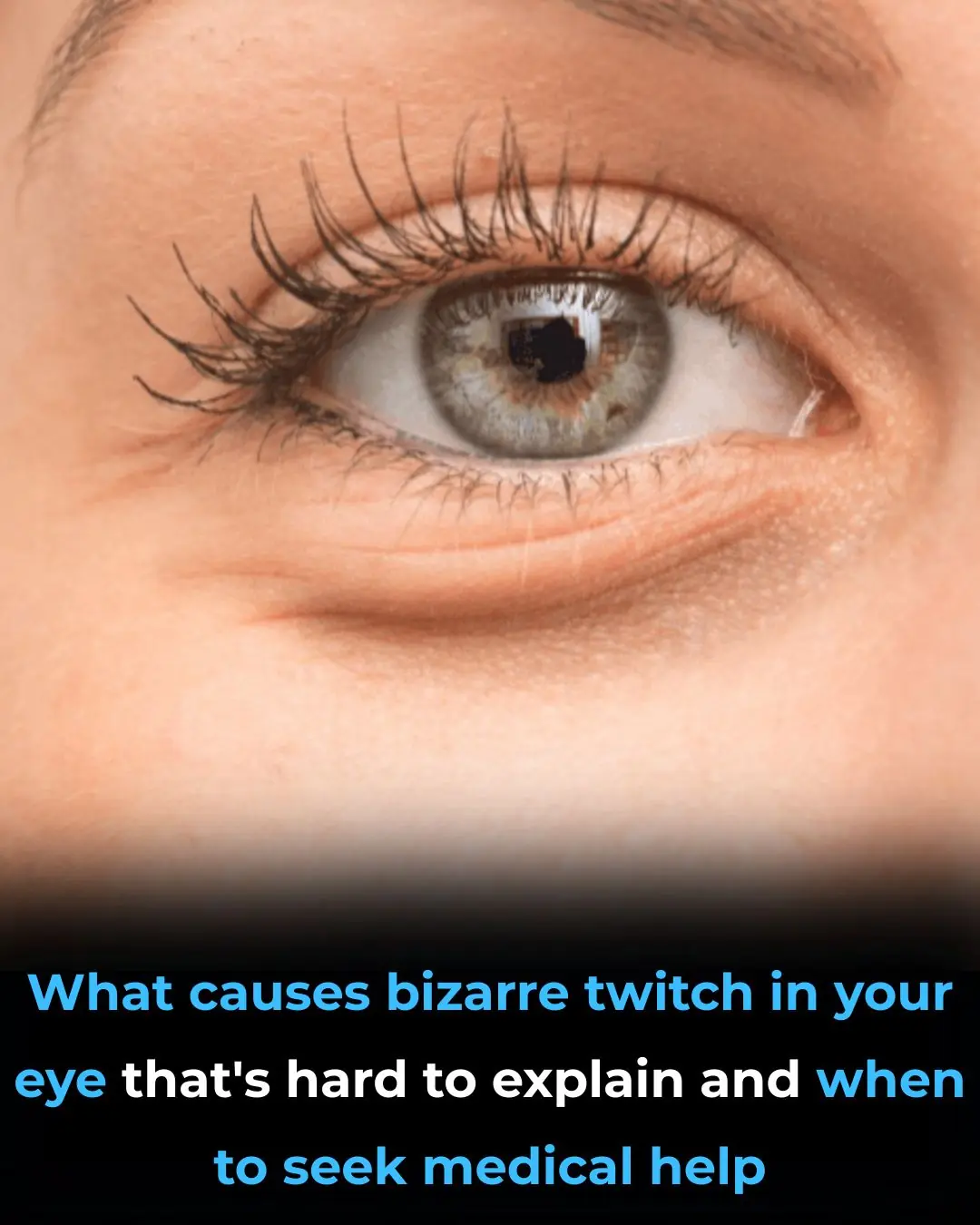 What Causes That Bizarre Eye Twitch