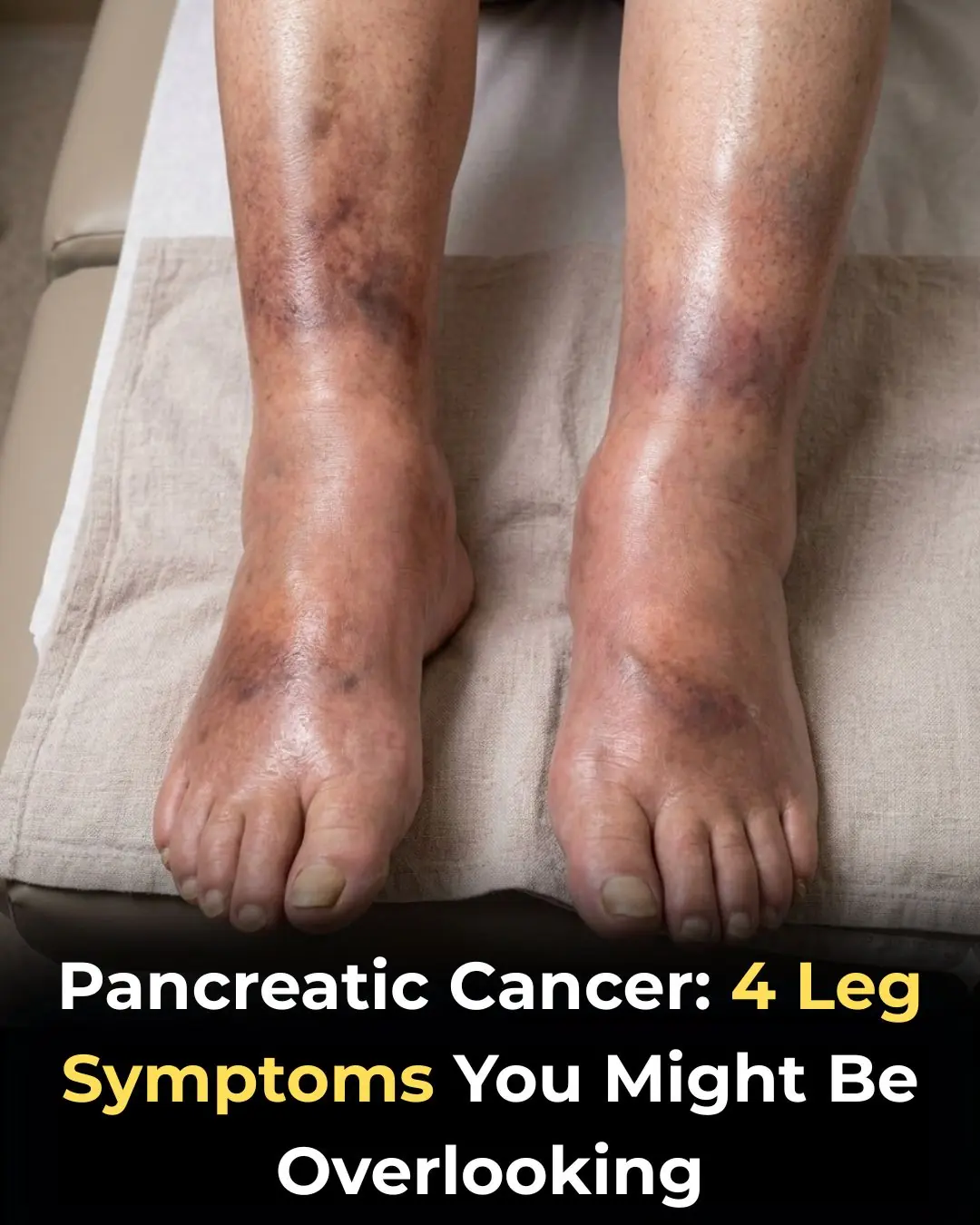 The Silent Signal: What Your Legs May Reveal About Pancreatic Health