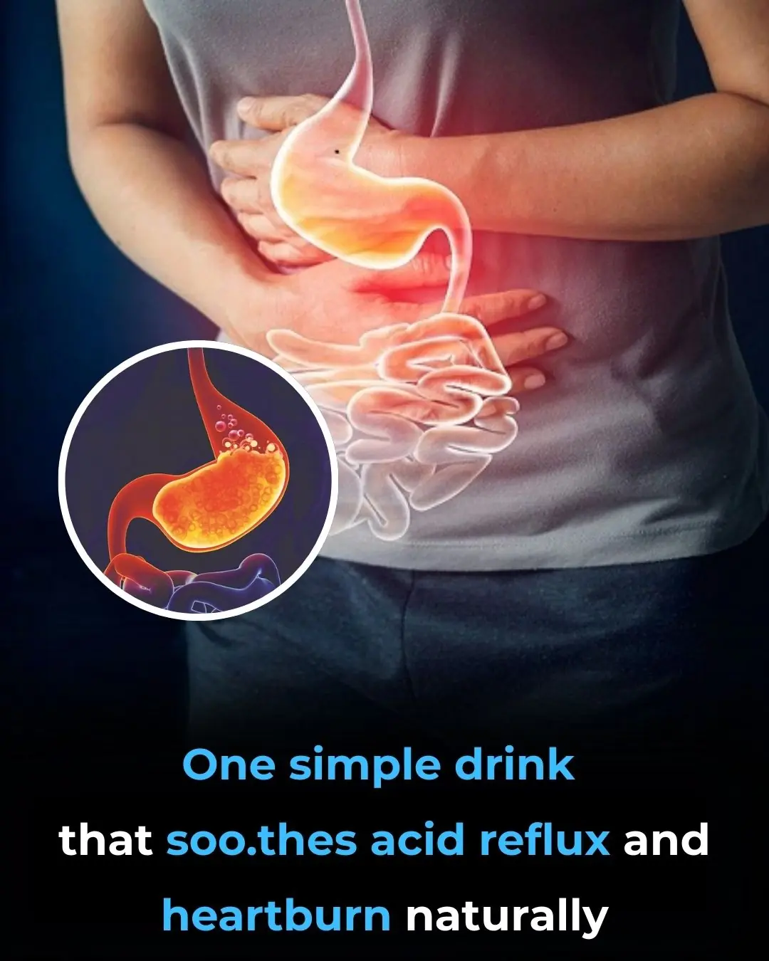Natural Drinks That May Help Soothe Acid Reflux and Heartburn