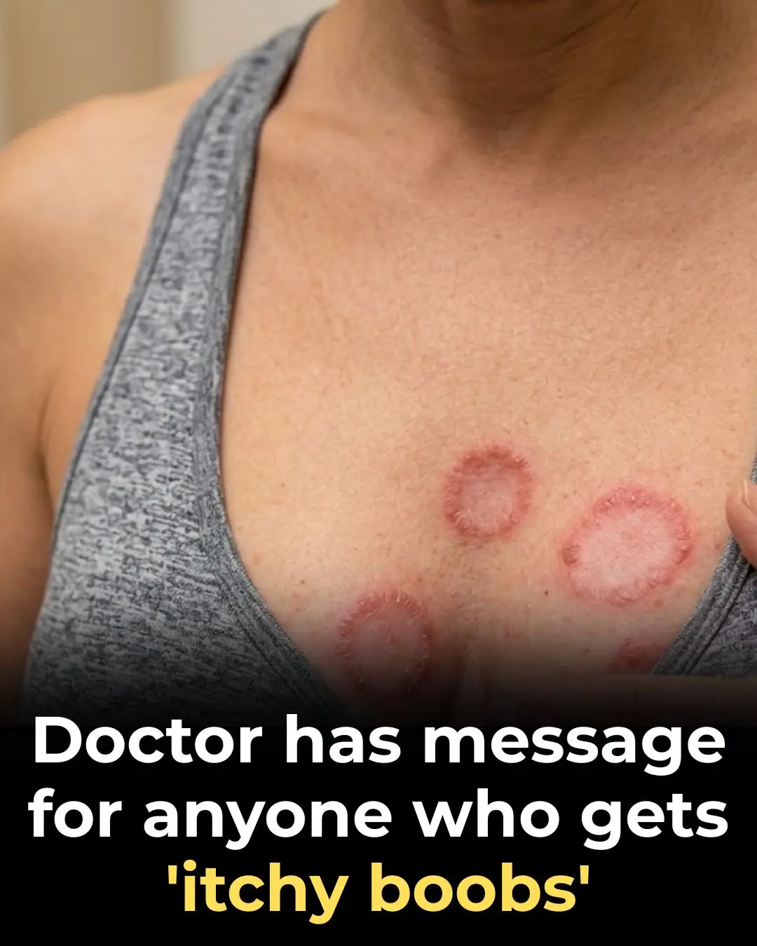 Itchy Breasts? Here Are 6 Health Issues That Could Be Behind It