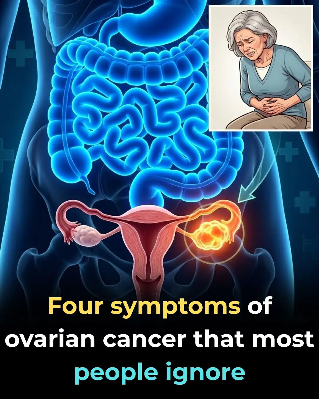 Early Symptoms of Ovarian Cancer