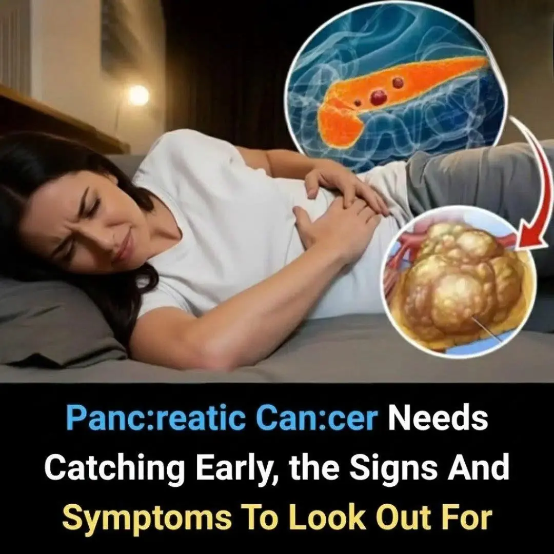 Pancreatic Cancer: 10 Early Warning Signs You Should Never Ignore