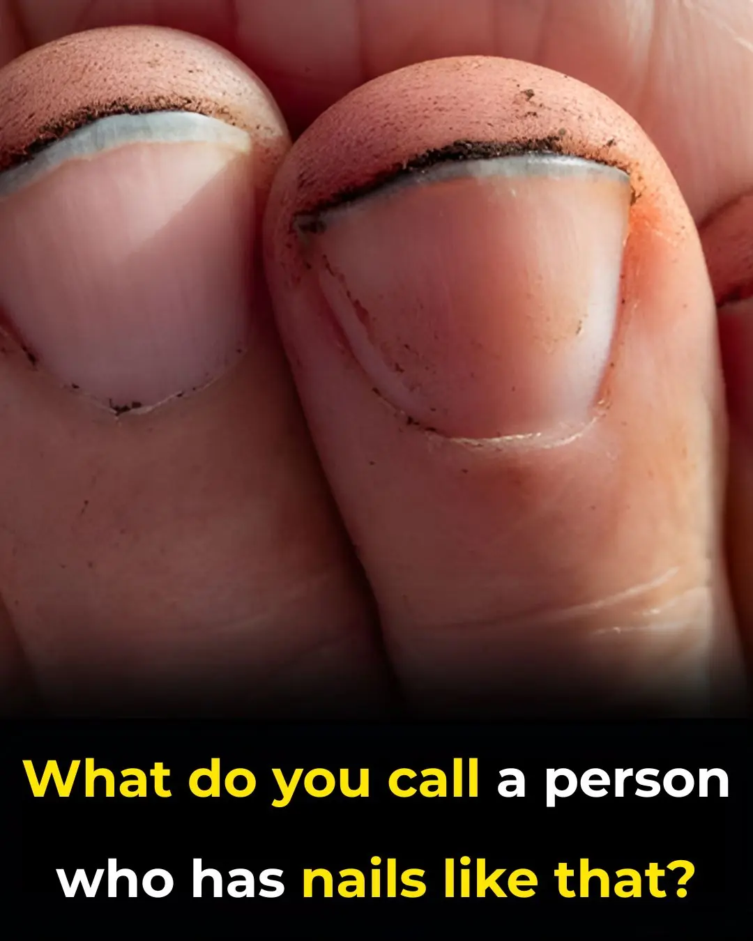 What do you call a person with nails like that?
