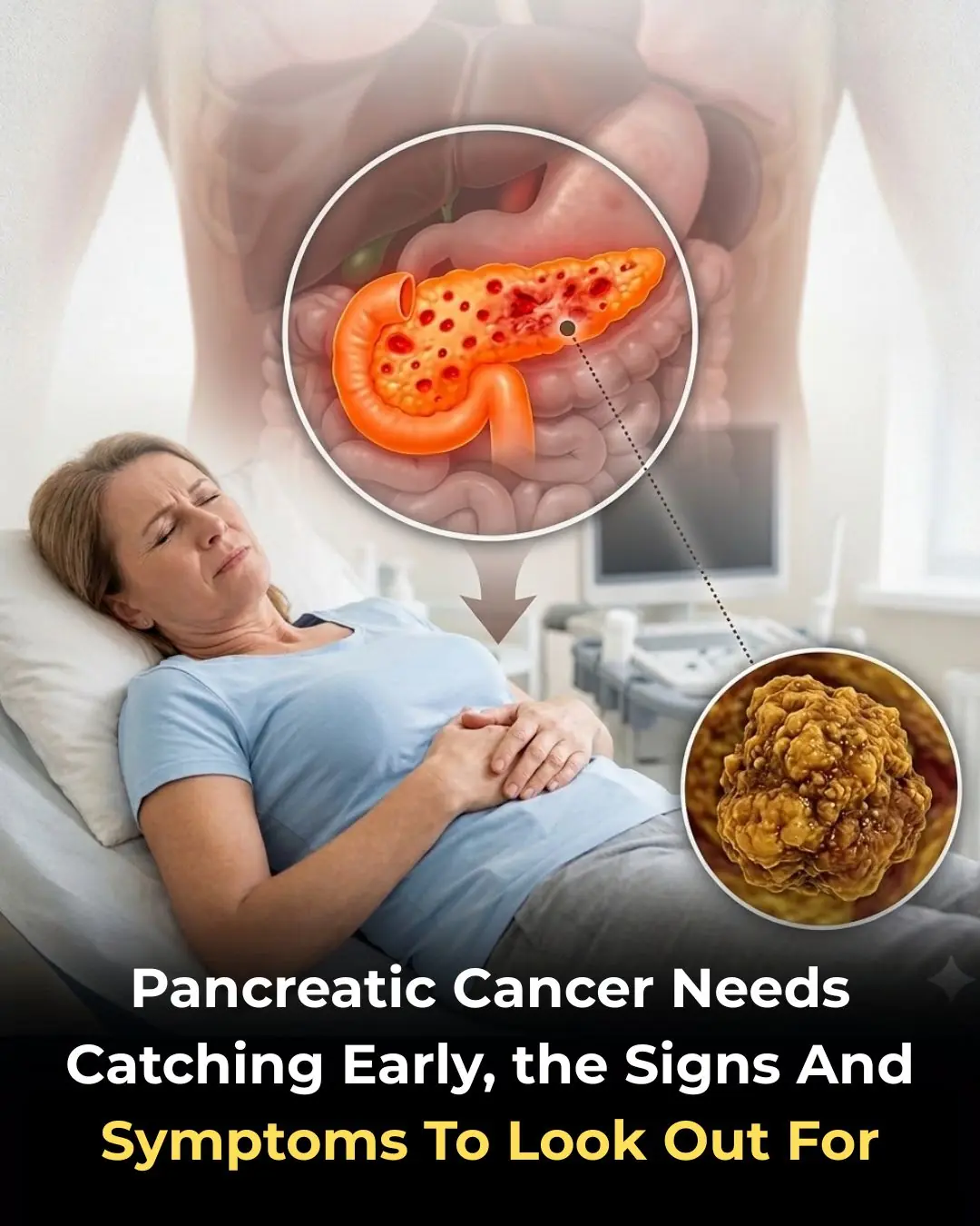 Pancreatic Cancer: 10 Early Warning Signs You Should Never Ignore