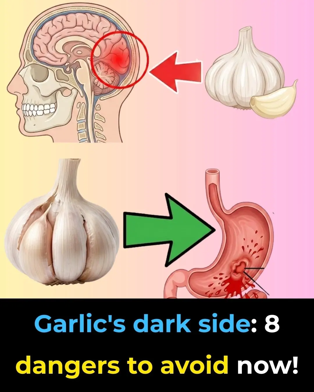 Eat Garlic Daily, But Avoid These 8 Common Mistakes That Ruin Its Benefits