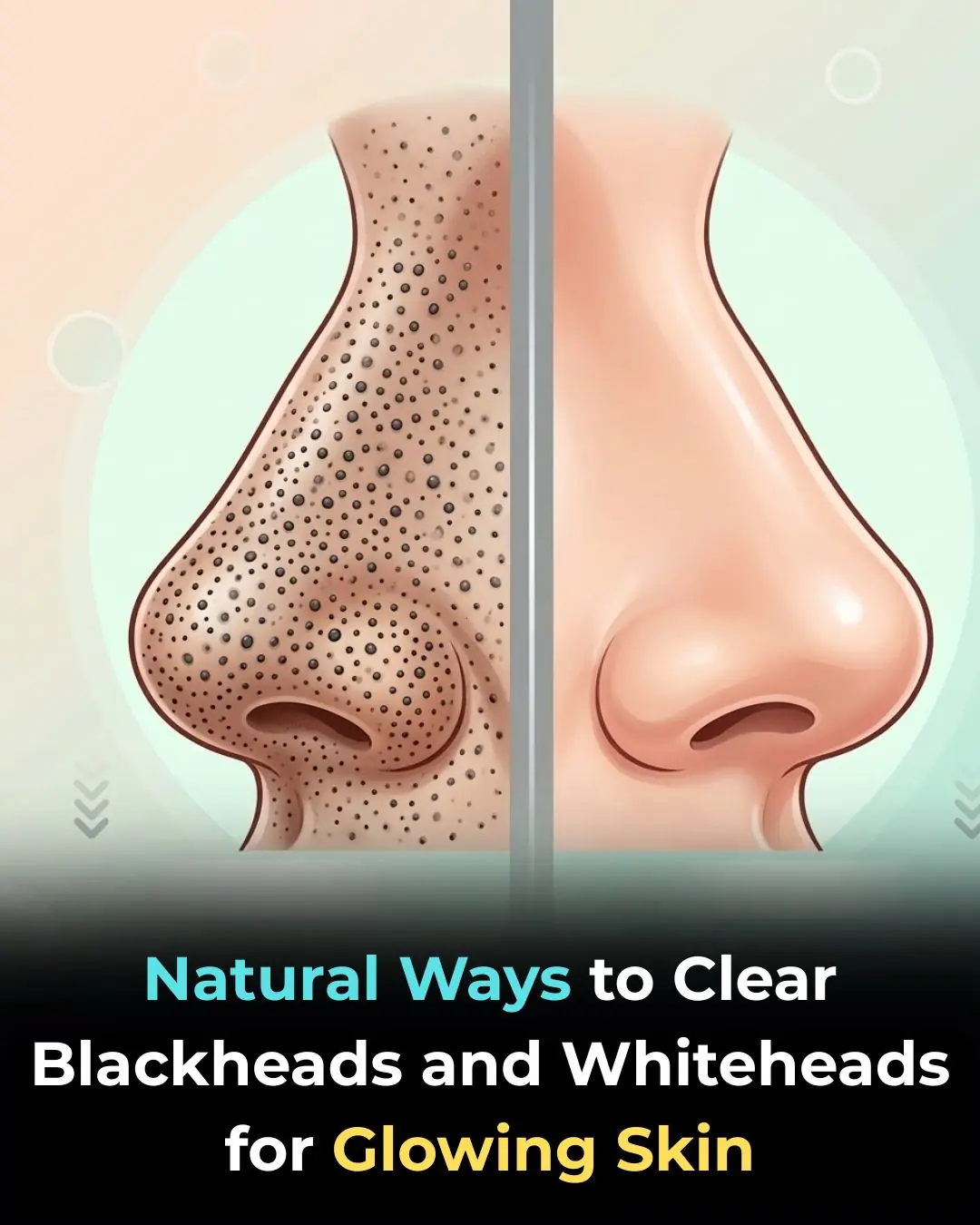 Natural Ways to Clear Blackheads and Whiteheads