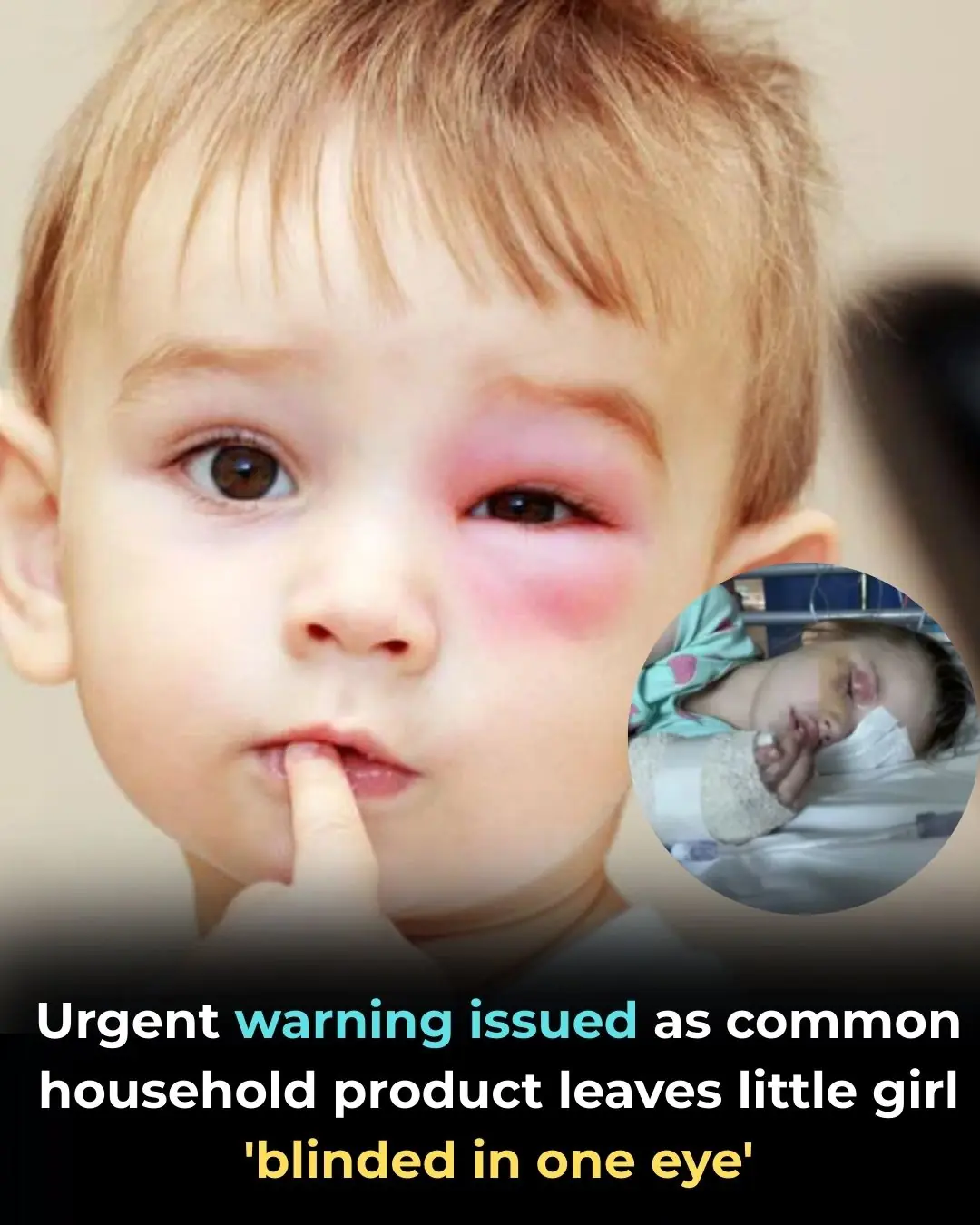 Urgent warning after girl is blinded from household product