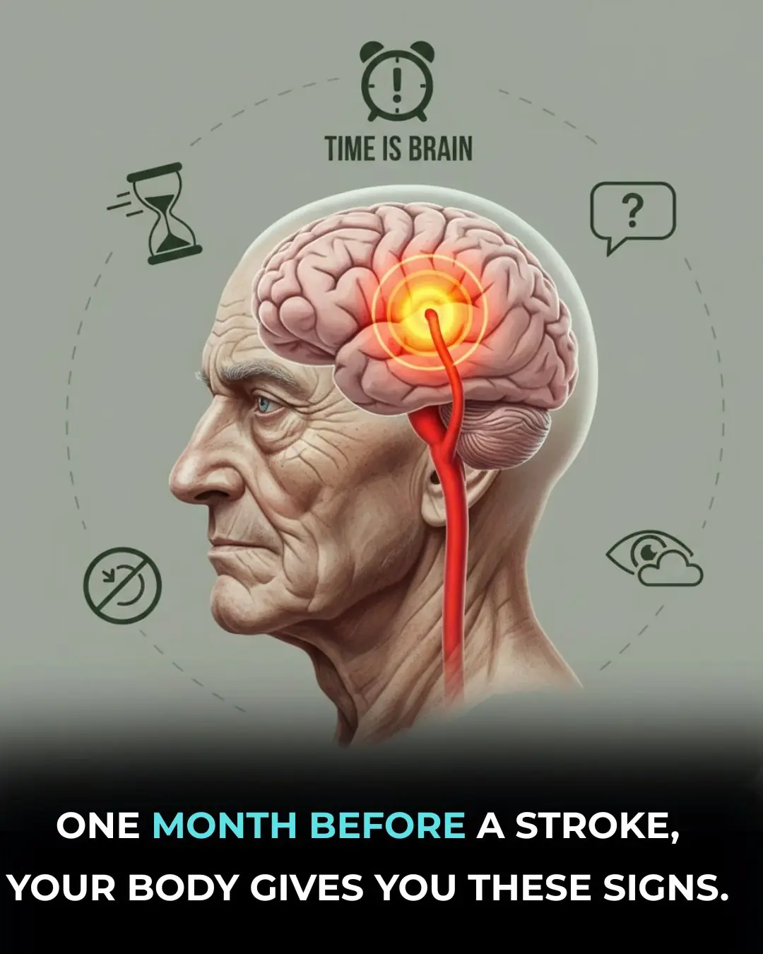 Recognizing a Stroke Fast