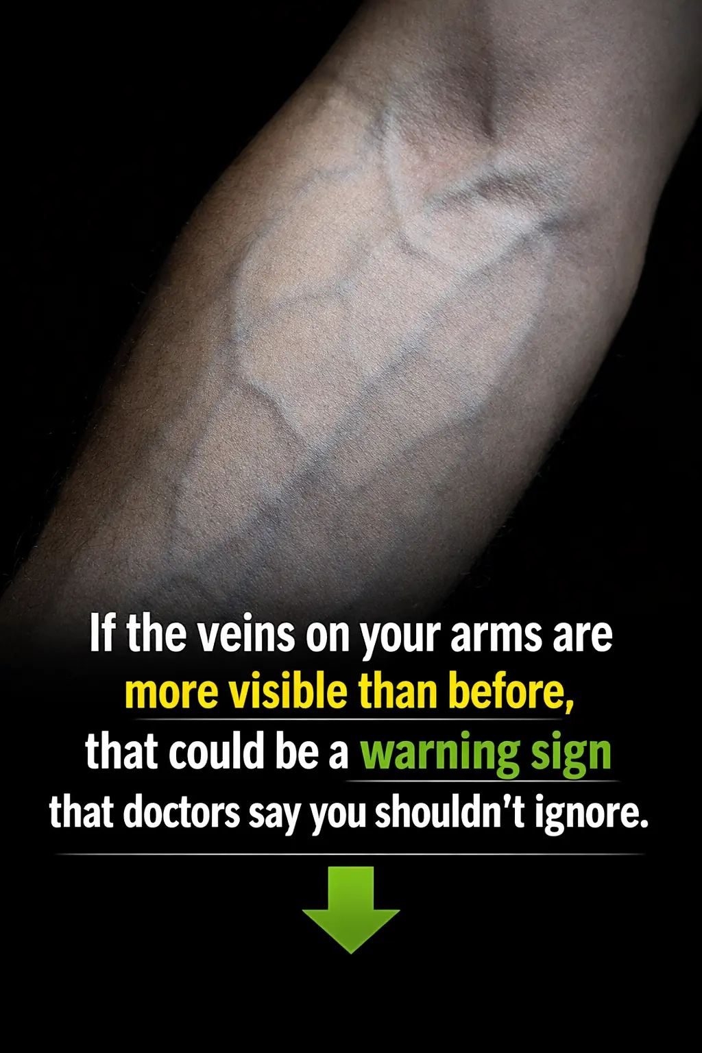 The Science Behind the Bulge: Why Do Veins Surface?