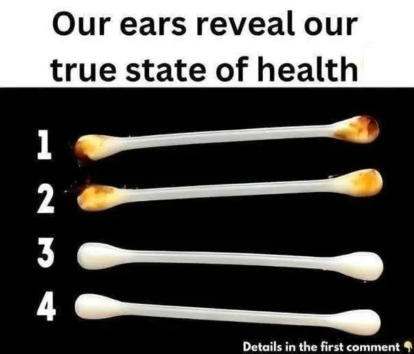 What Your Ears Can Reveal About Your Health