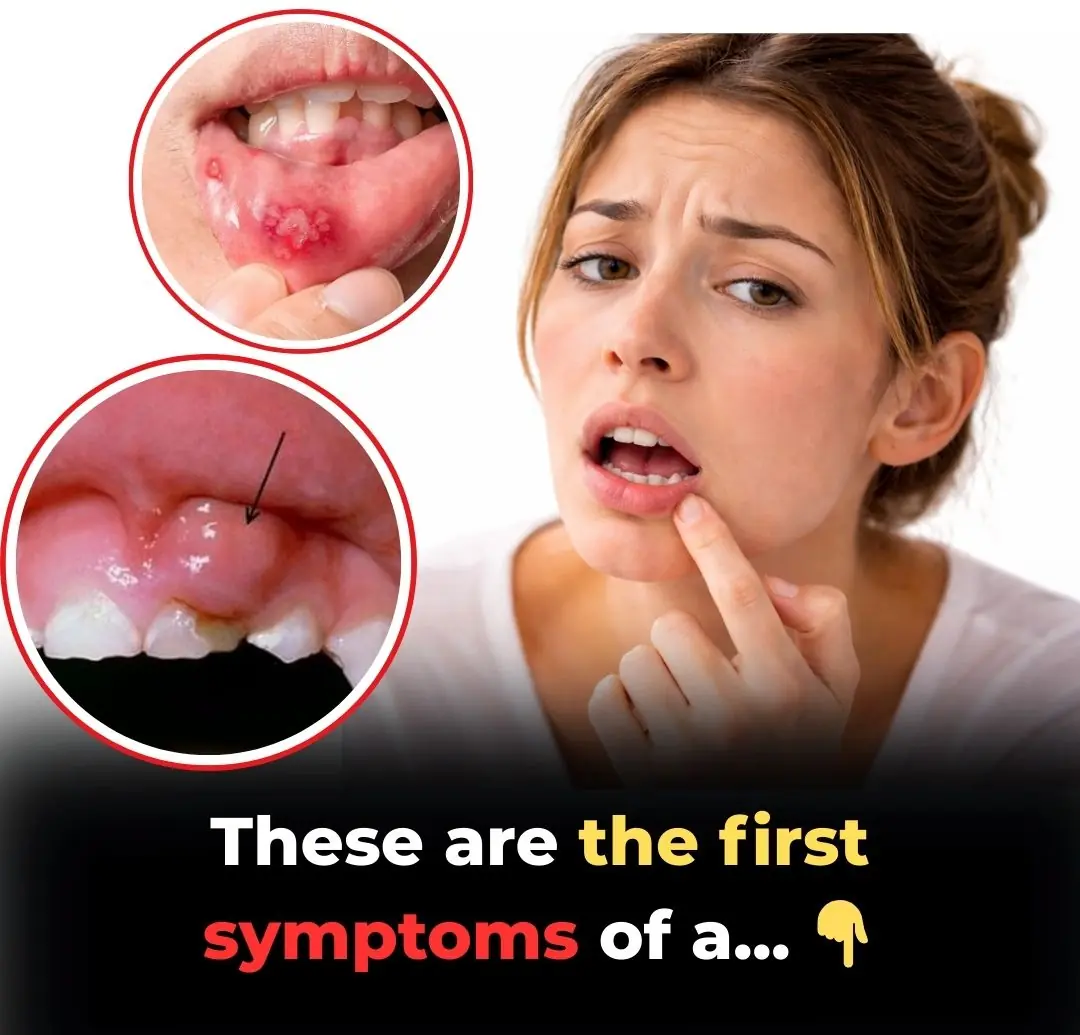 Is Your Mouth Trying to Tell You Something? 5 Hidden Warning Signs of Oral Cancer