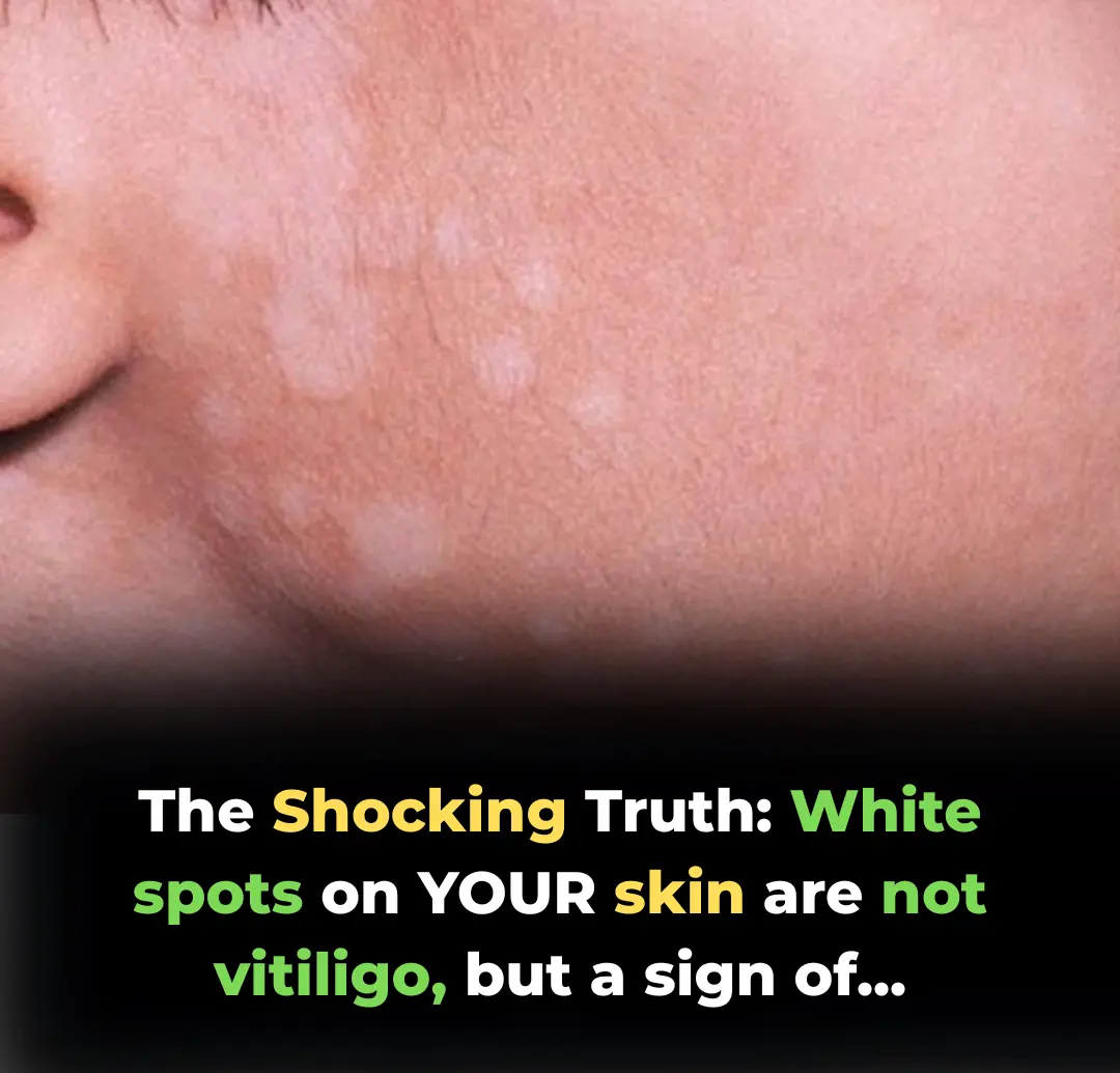 Sun Exposure and Pigment Alteration: The Hidden Truth Behind Tiny White Spots