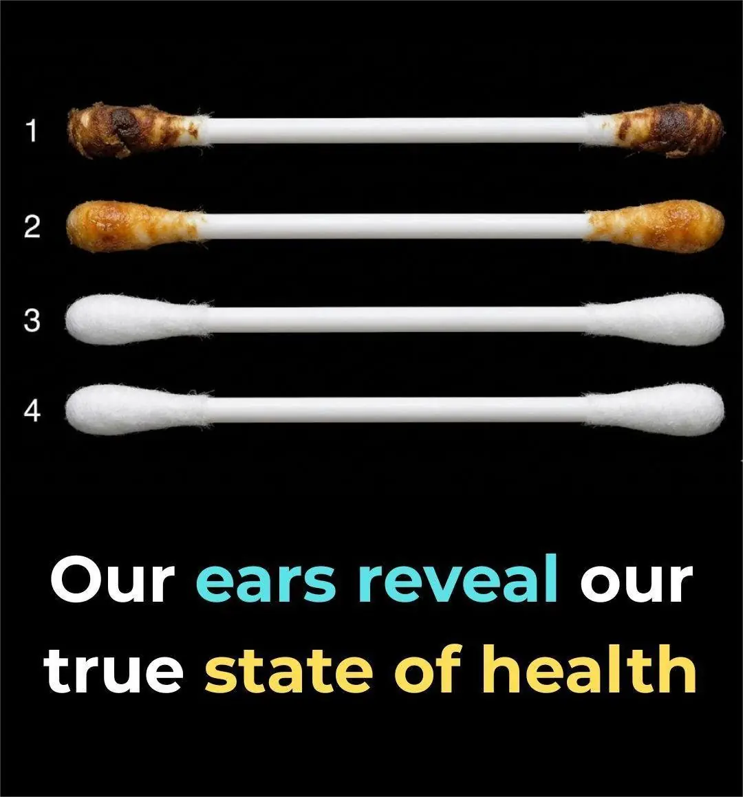 What Your Ears Can Reveal About Your Health