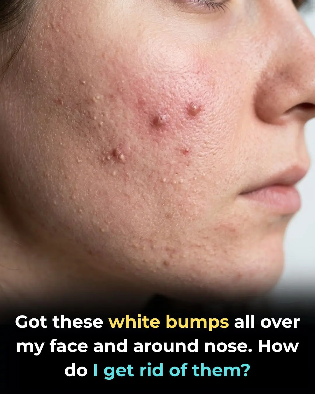 I truly am bothered by these!