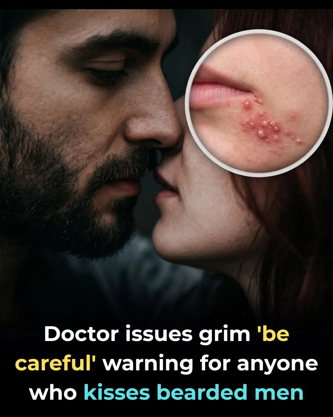 The Hidden Health Risks of Kissing A Bearded Man