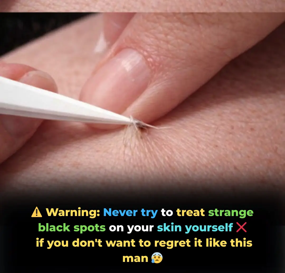 The Mystery of the Black Spot: The Chilling Truth Behind a Seemingly Harmless Act