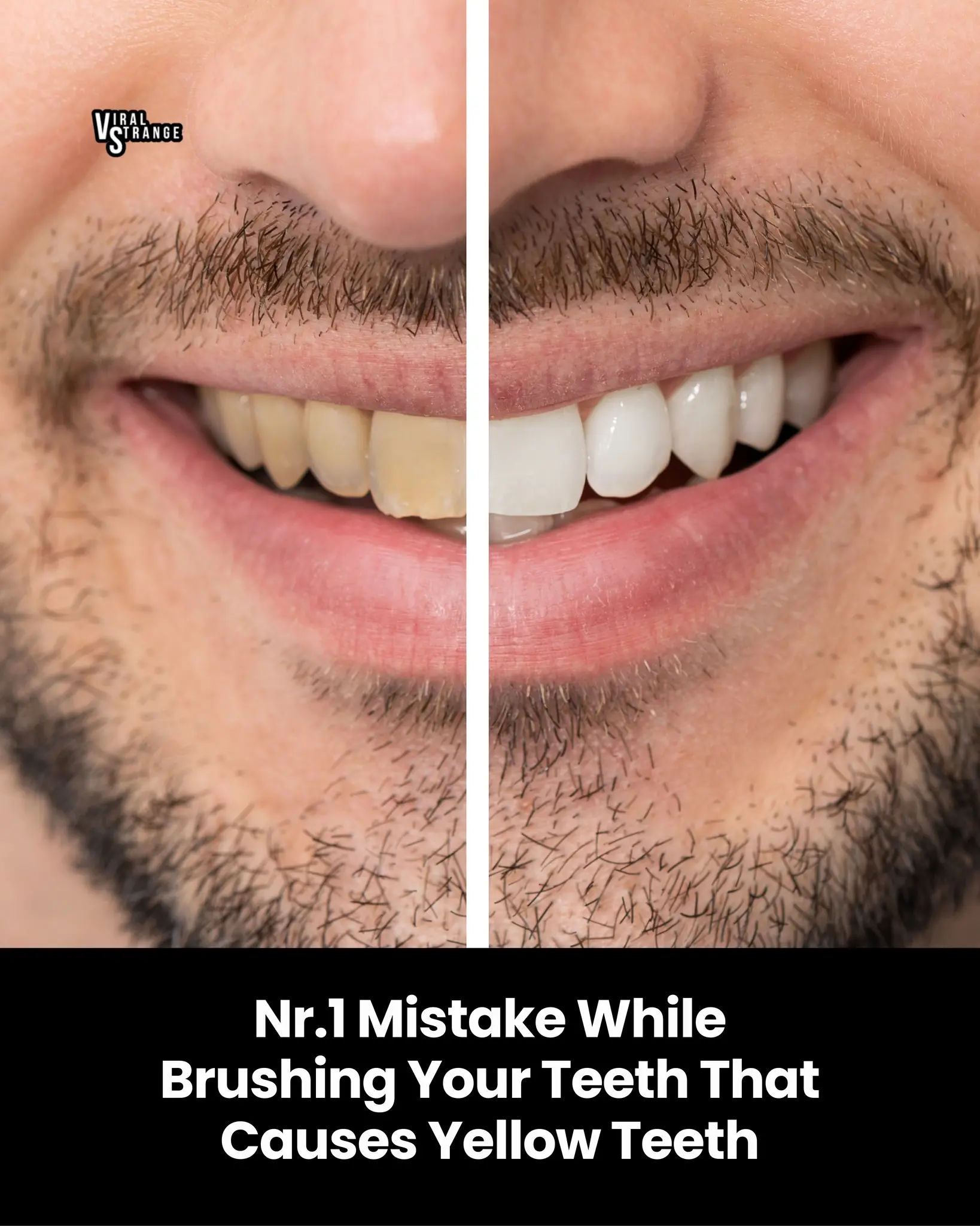 One Morning Habit Could Be Turning Your Teeth Yellow