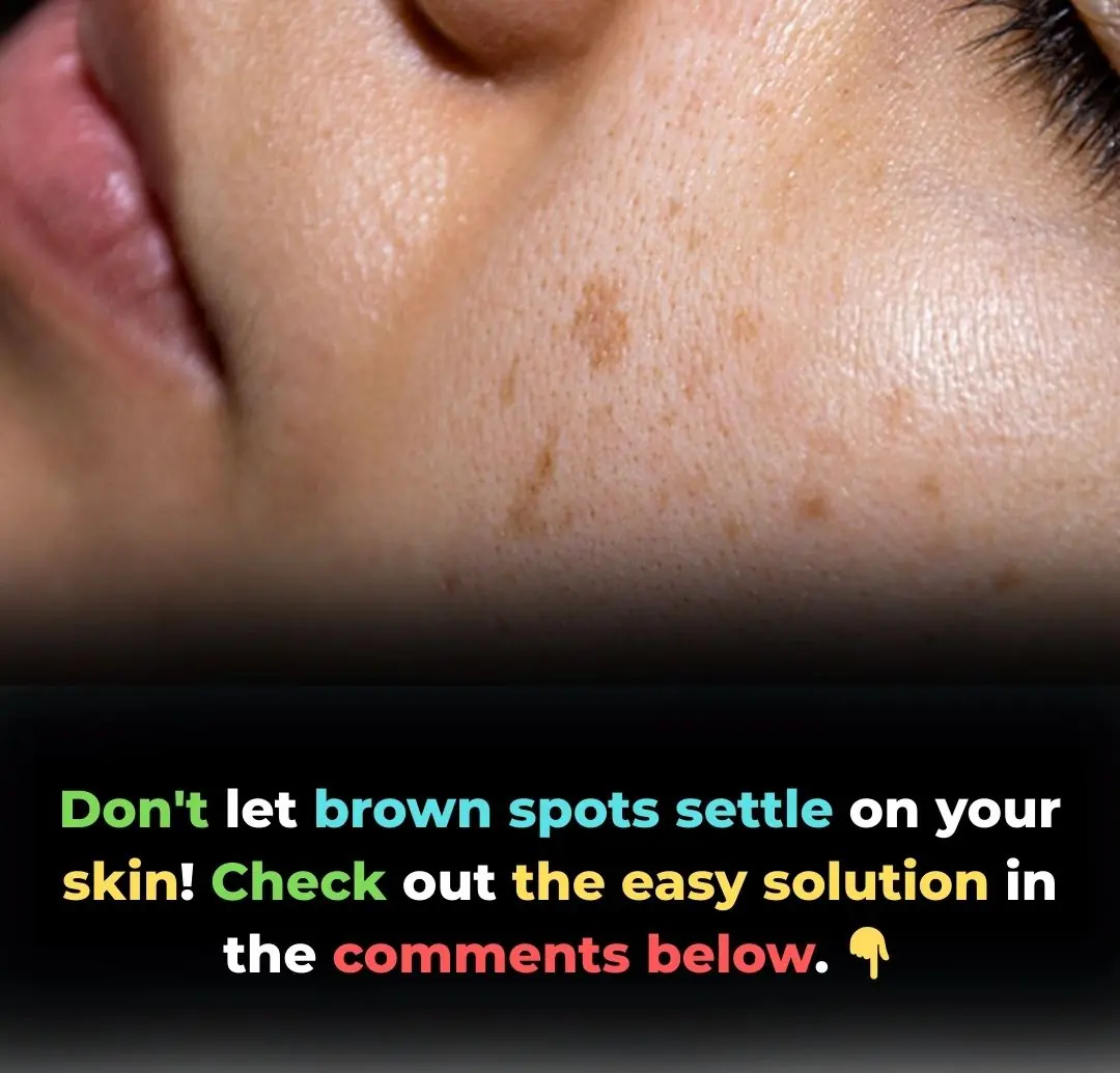 Causes and Solutions for Dark Spots