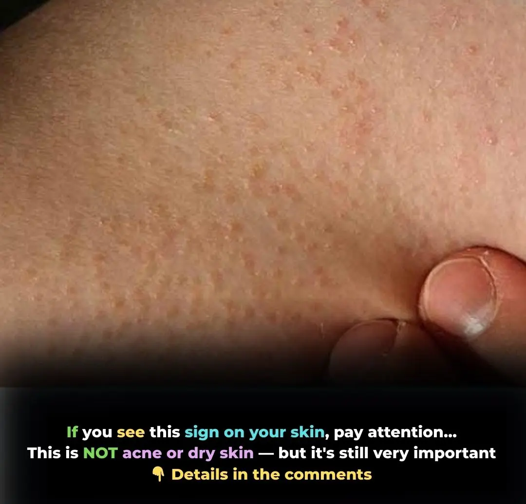 More Than Just Dry Skin: The Truth Behind Those Tiny Bumps on Your Arms