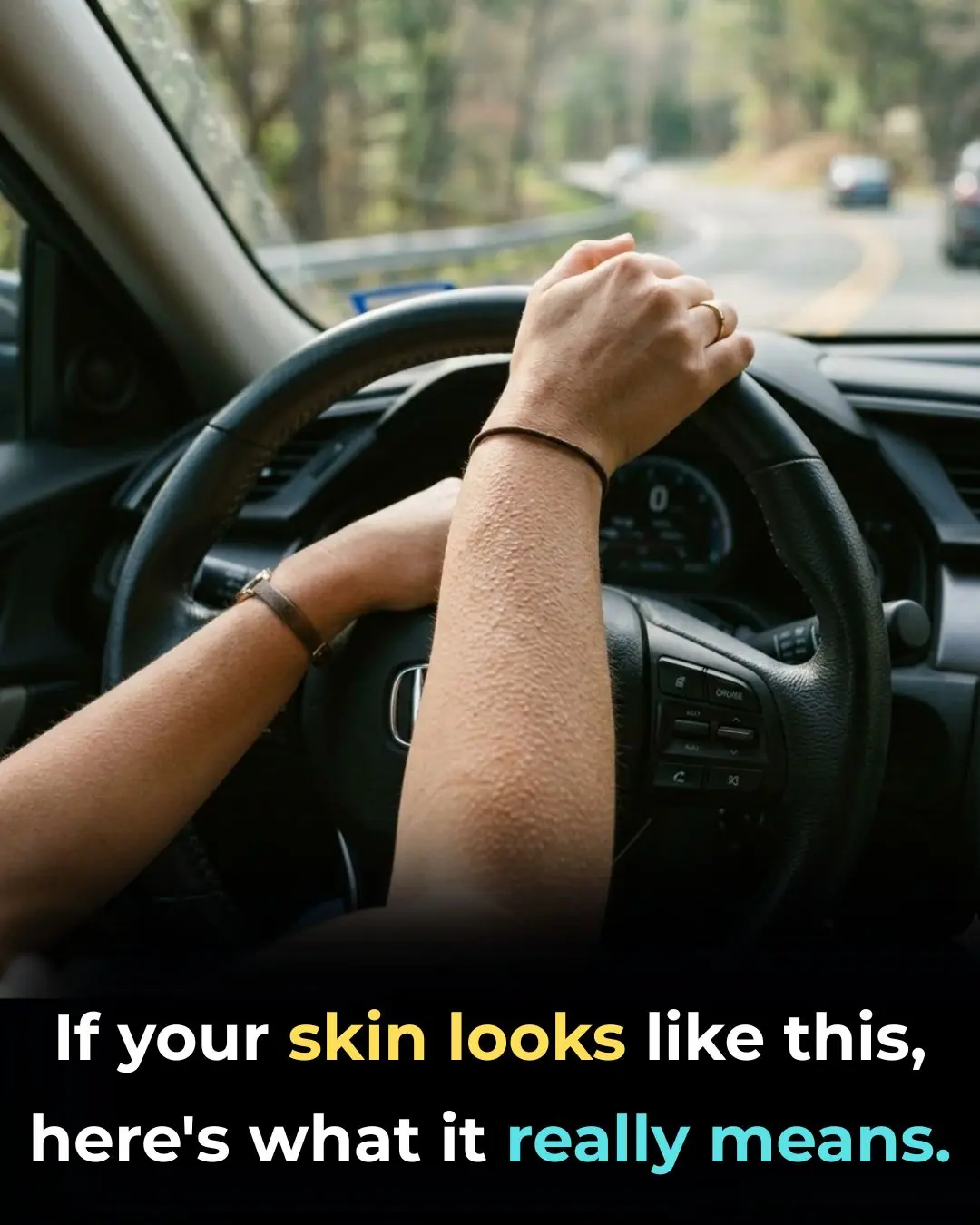 If Your Skin Looks Like This, Here's What It May Really Mean