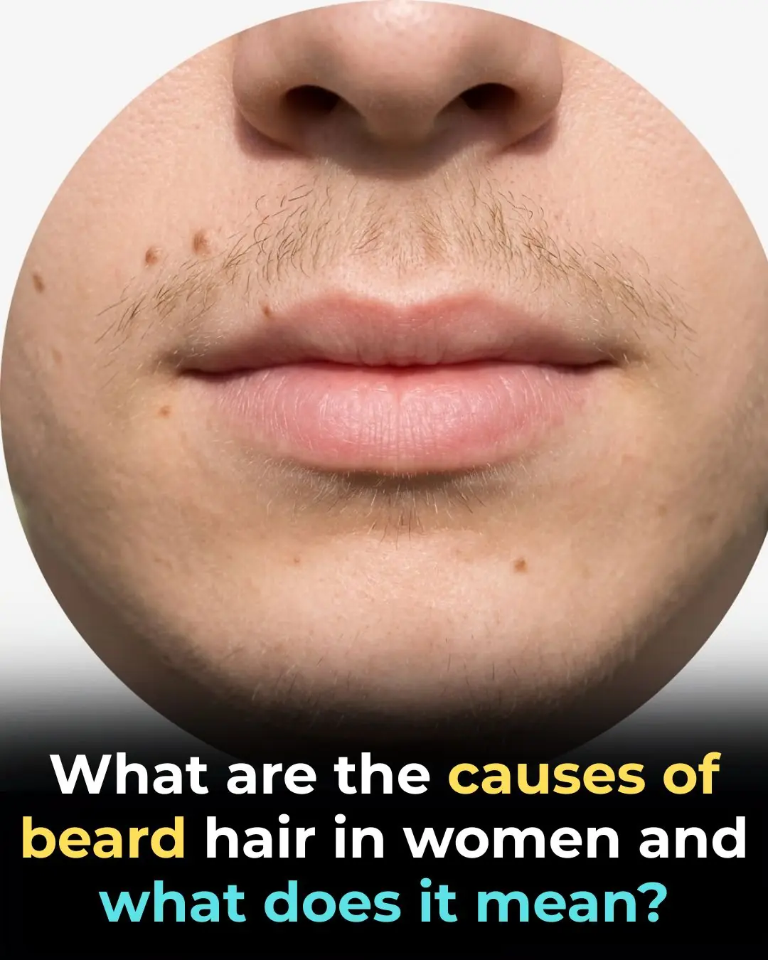 Why Some Women Grow Chin Hair