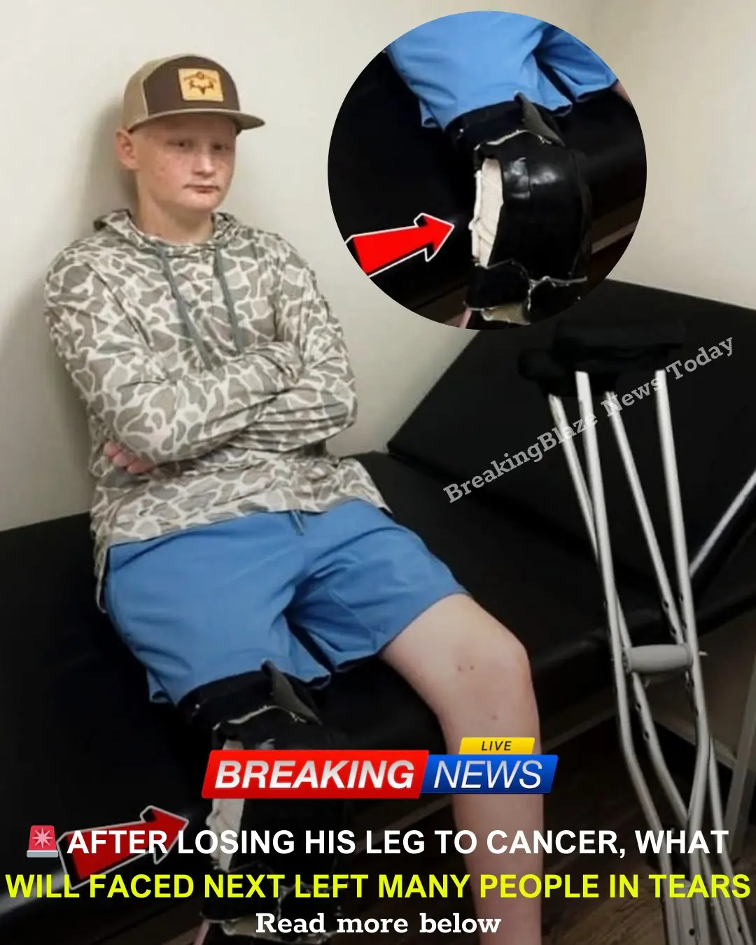 🚨 HE LOST A LEG TO CANCER… BUT WHAT WILL ROBERTS DID NEXT LEFT PEOPLE SILENT