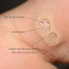 These “Harmless” Skin Bumps Might Be More Than You Think