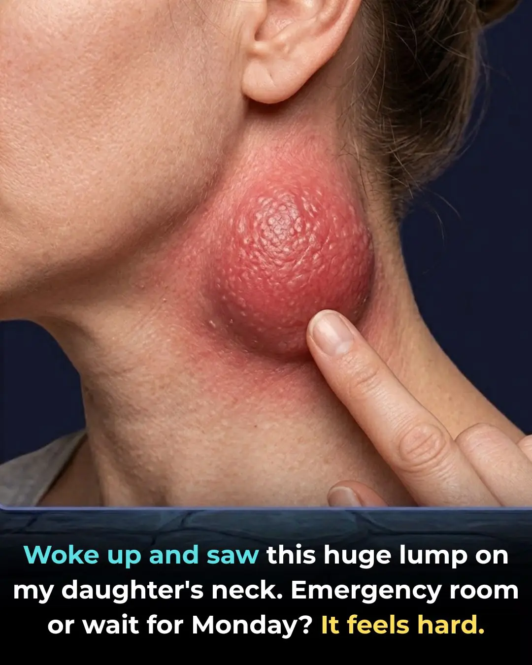Woke up and saw this huge lump on my daughter’s neck. Emergency room or wait for Monday? It feels hard.