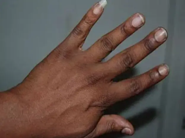 Why do some men grow this nail long?