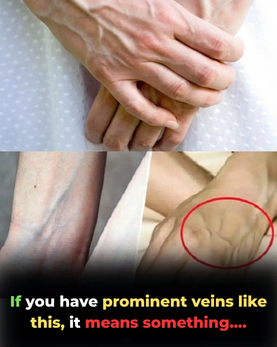 If You Have Visible Veins, It Means You Are... (The Truth Behind Popping Veins)