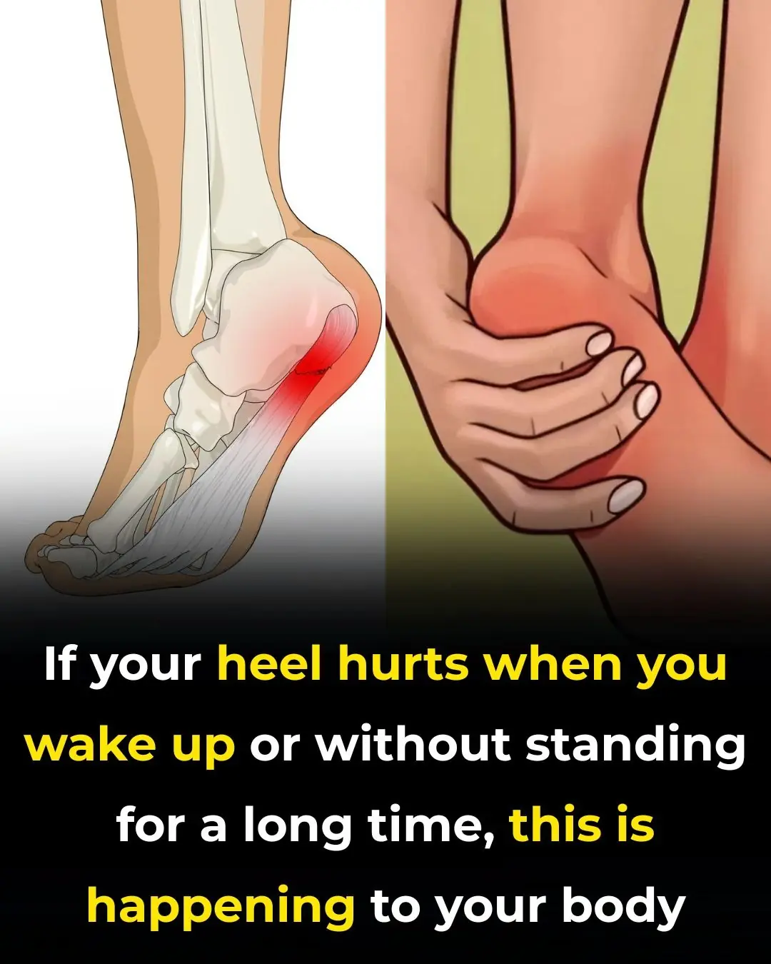 7 Powerful Exercises to Relieve Heel Pain and Treat Plantar Fasciitis Naturally