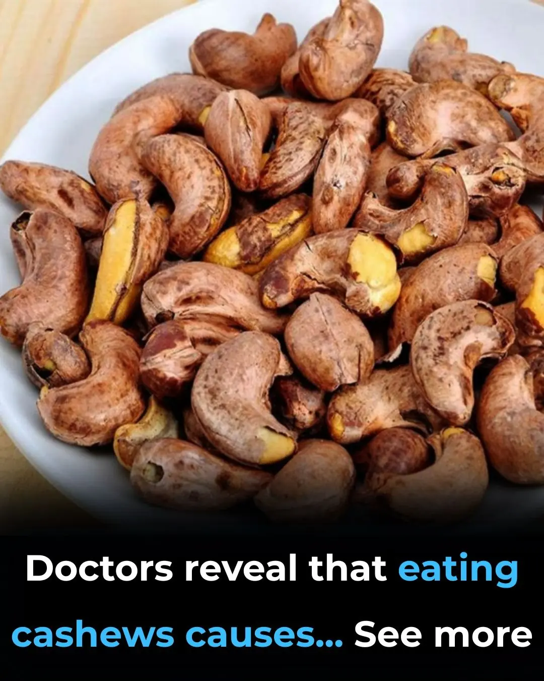 HomeDoctors Reveal That Eating Cashews Causes Remarkable Health Benefits Doctors Reveal That Eating Cashews Causes Remarkable Health Benefits