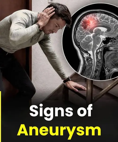 Signs of Aneurysm...