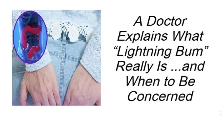 A Doctor Explains What “Lightning Bum” Really Is