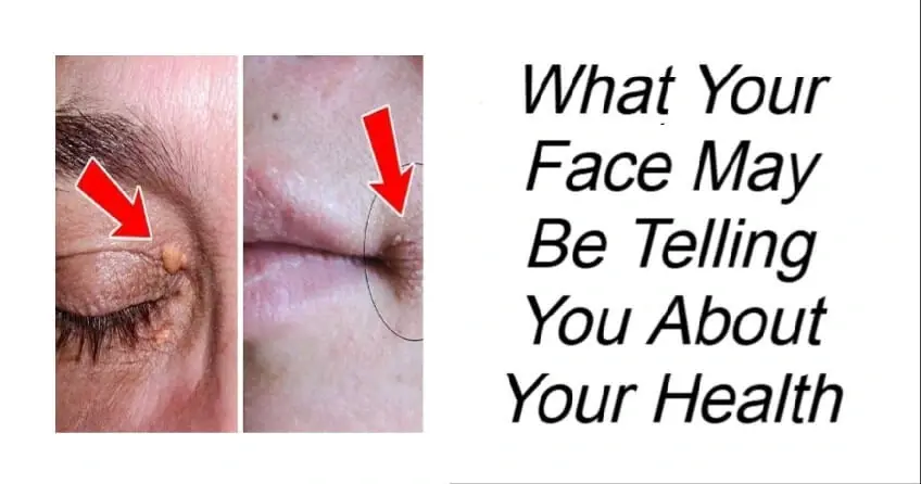 What Your Face May Be Telling You About Your Health
