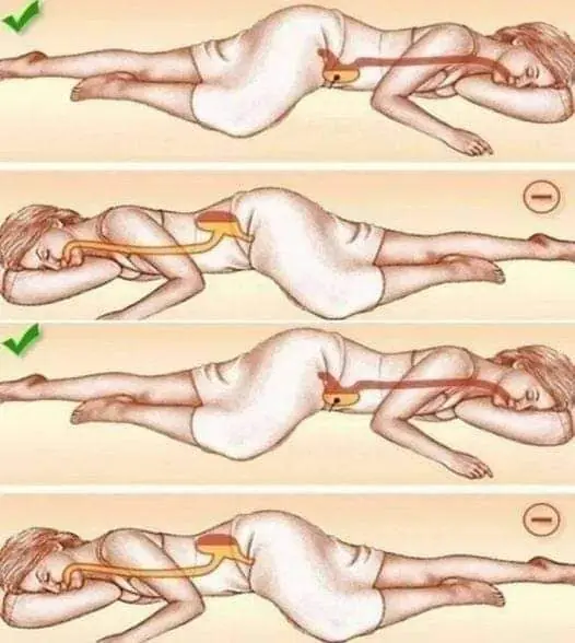 Health Benefits of Sleeping on Your Left Side