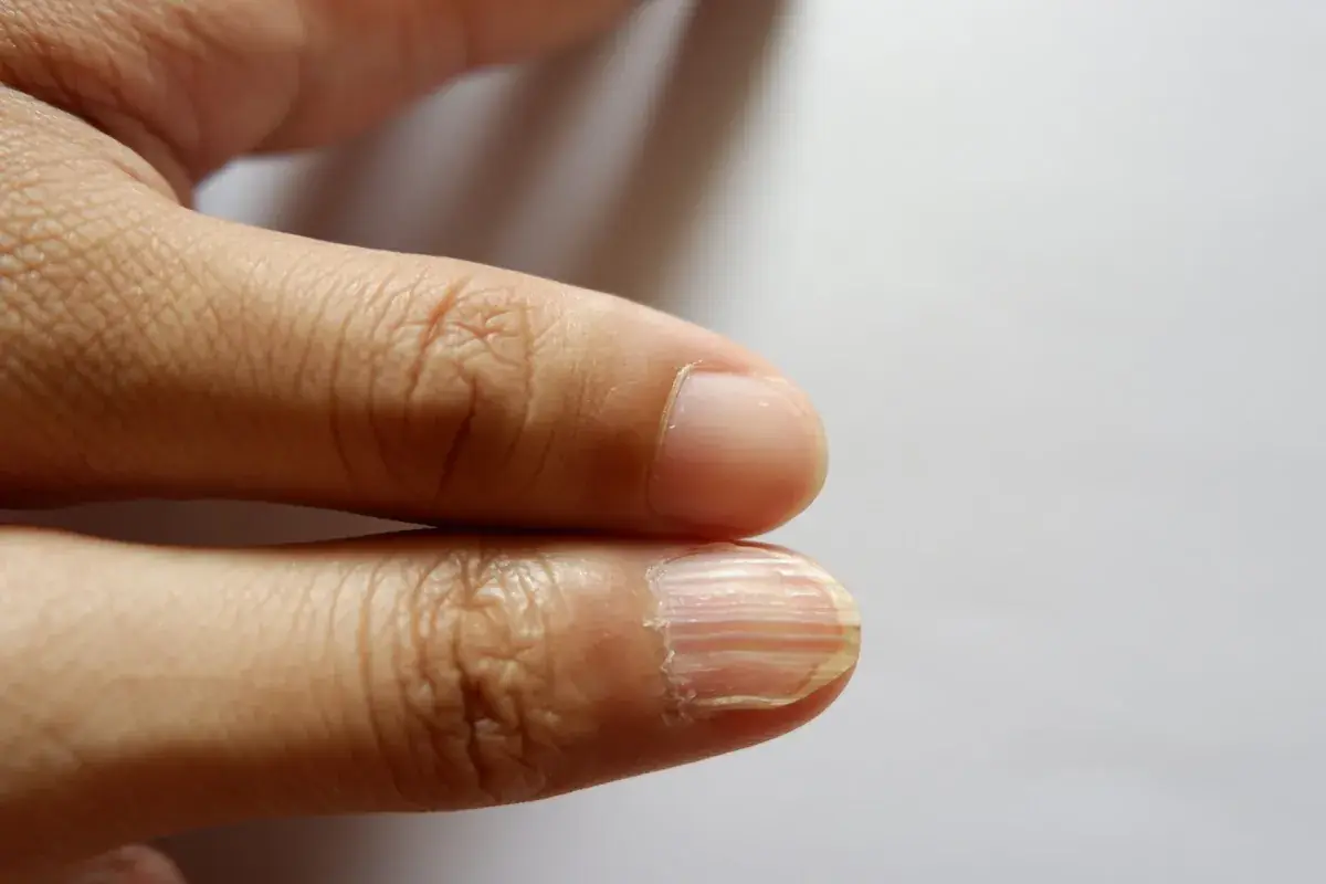 The Hidden Health Clues You’re Missing Every Time You Look at Your Nails