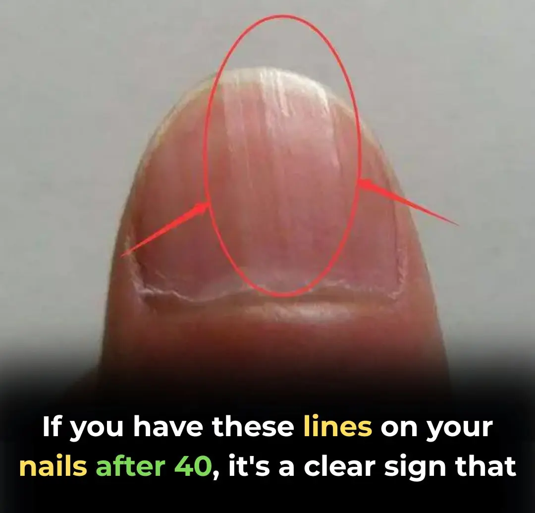 The Best Foods for Stronger Nails After 40