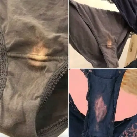 Bleach Spot On Your Underwear