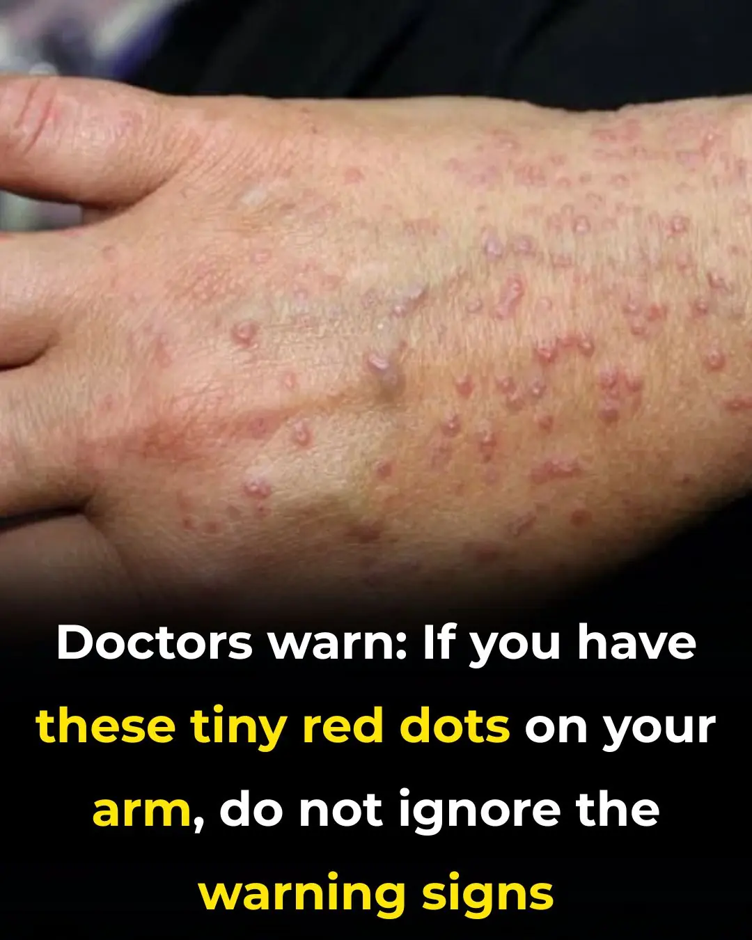 Don’t Overlook These Small Red Spots on Your Arm: Warning Signs What Are These Red Spots?