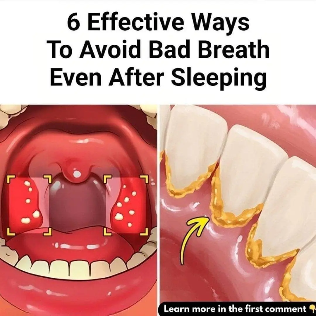 5 Effective Ways to Get Rid of Bad Breath