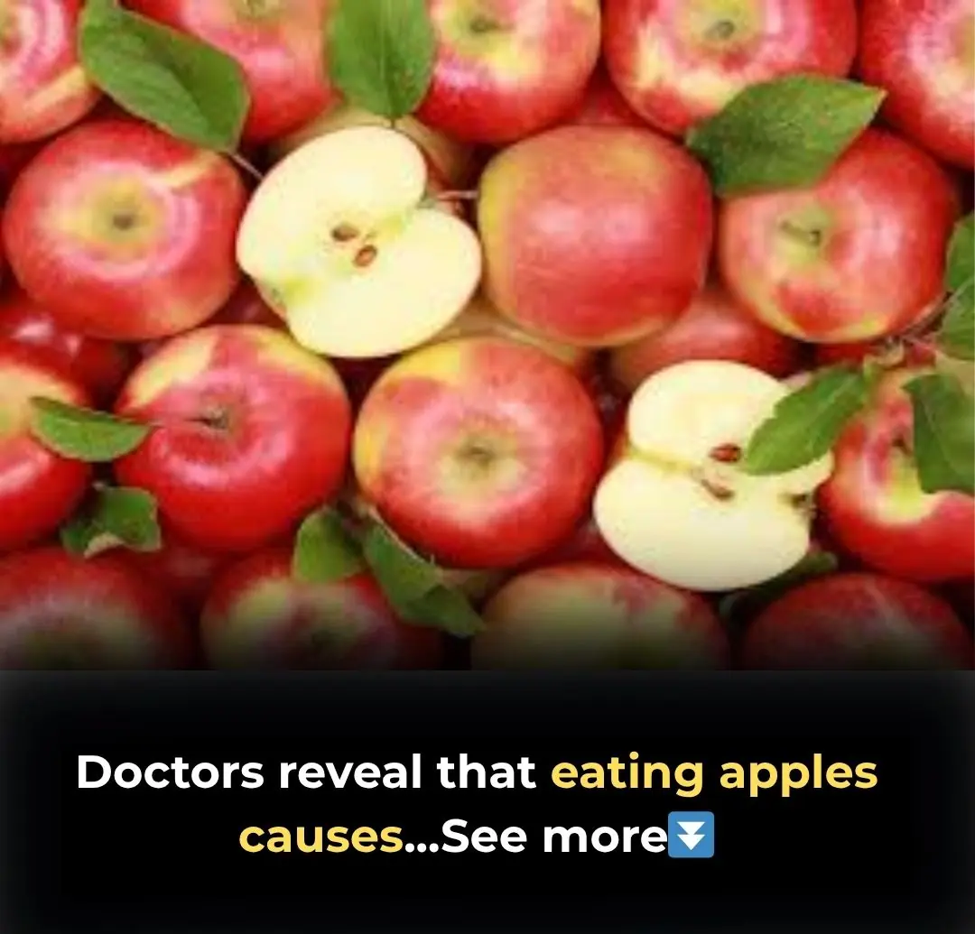 he Surprising Truth Behind "An Apple a Day": What Doctors Really Think