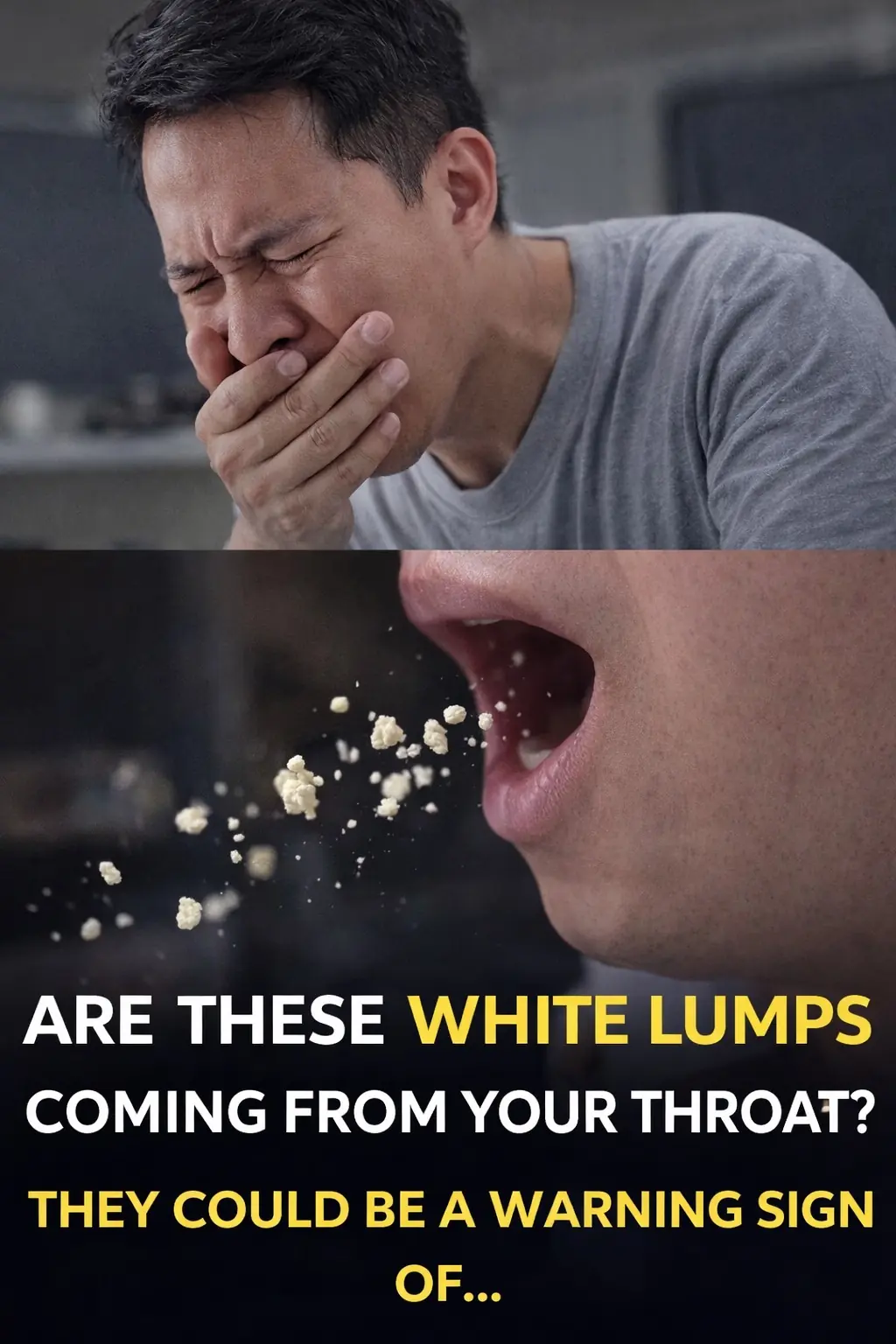 Tonsil Stones: Causes, Symptoms, and Solutions