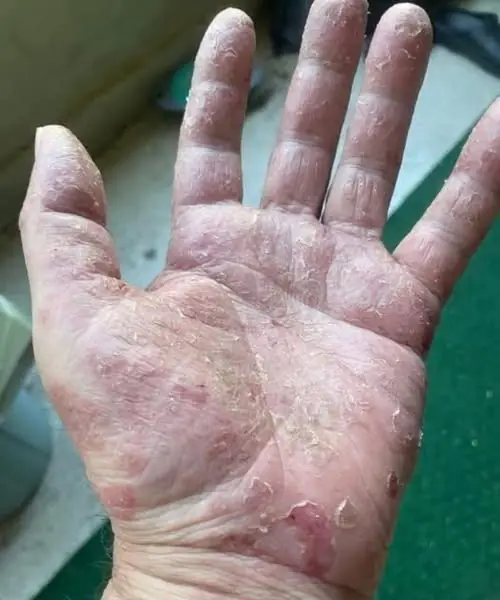If Your Hands Start Looking Like This… It’s Not Just Dry Skin — It Could Be a Warning Sign