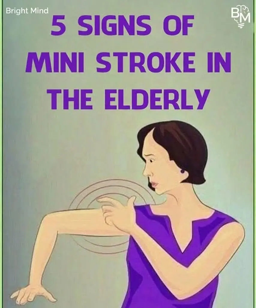 Mini-Stroke Symptoms in the Elderly — What You Should Never Ignore