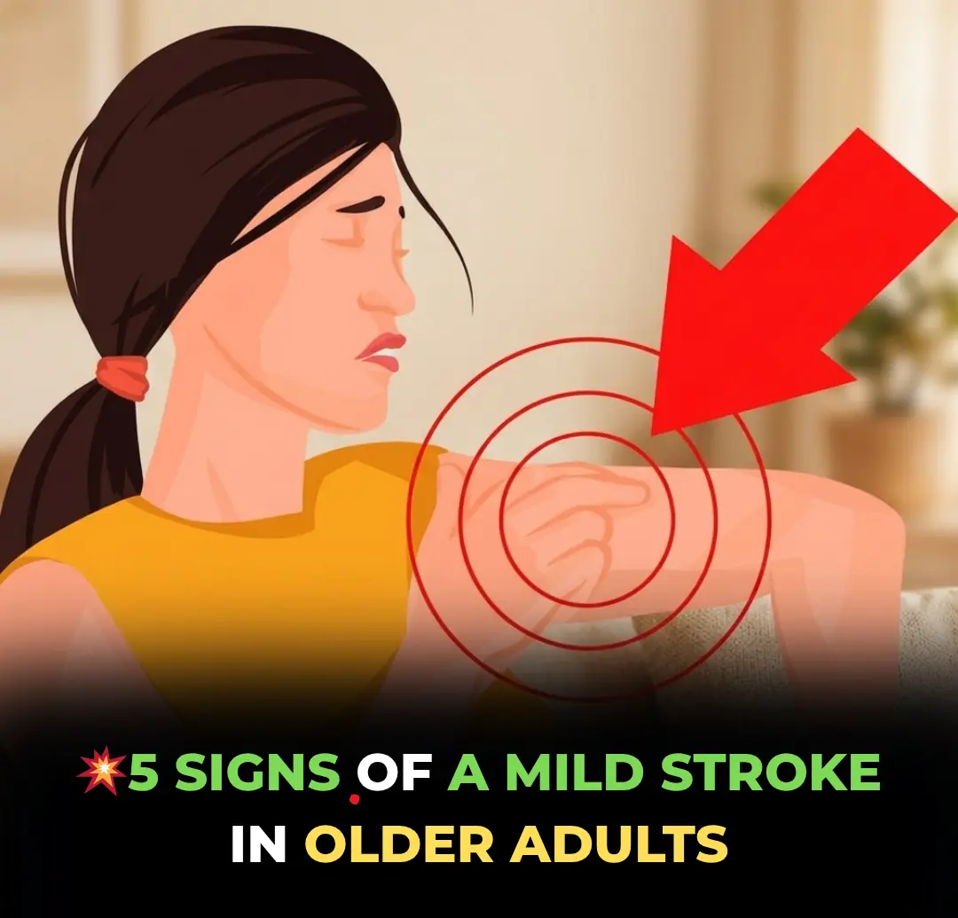 5 Signs of a Mini Stroke You Should Never Ignore