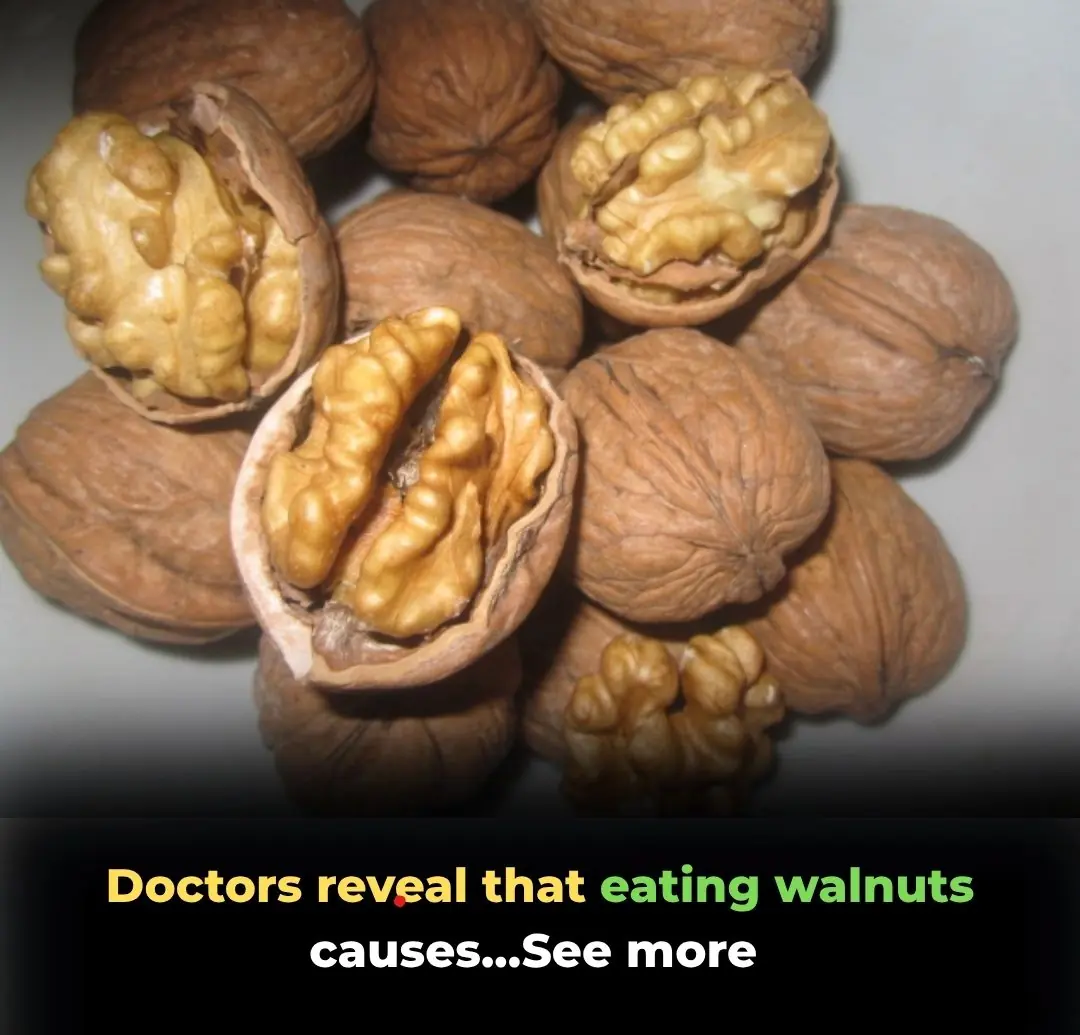 The Science-Backed Health Benefits of Walnuts: Why You Should Eat Them Every Day