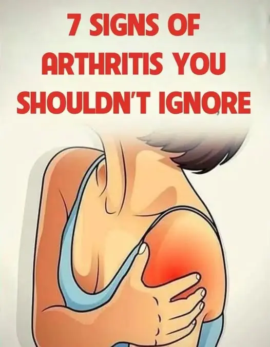 Signs of Arthritis You Shouldn’t Ignore