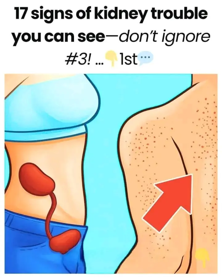 Warning Signs of Kidney Trouble You Can Actually See