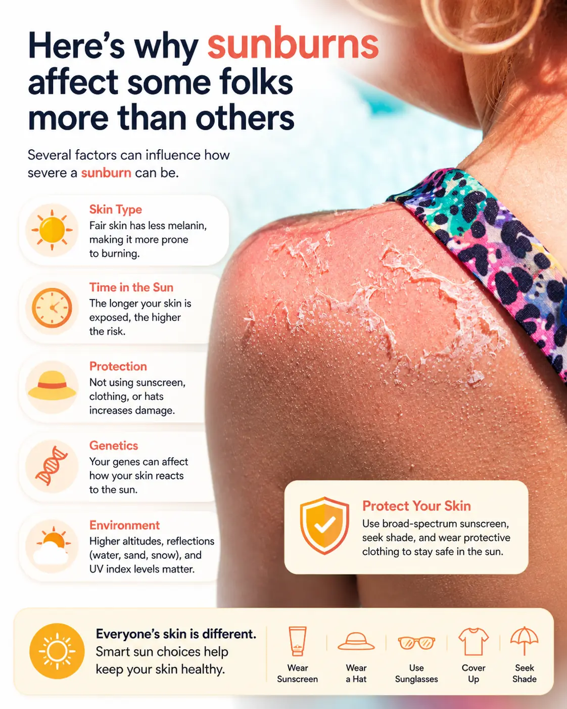 Why Some People Sunburn Easily
